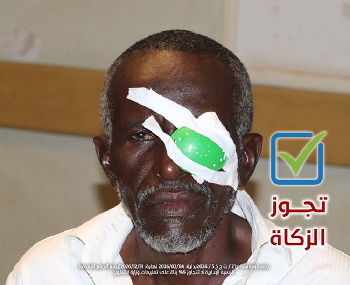 صورة عمليات العيون 9