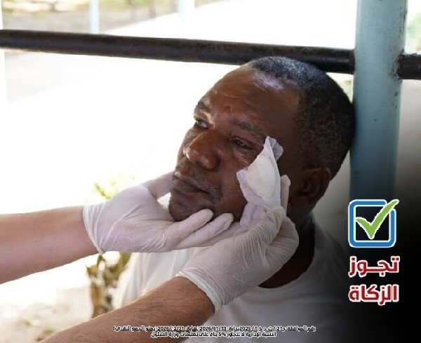 صورة عمليات العيون 10