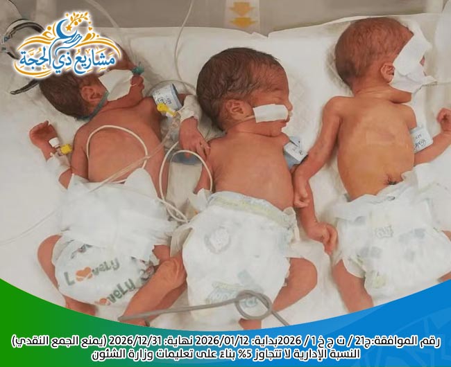 صورة مشروع حليب الاطفال