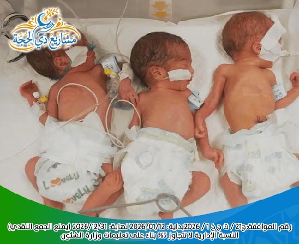 صورة مشروع حليب الاطفال