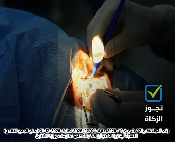صورة عمليات عيون